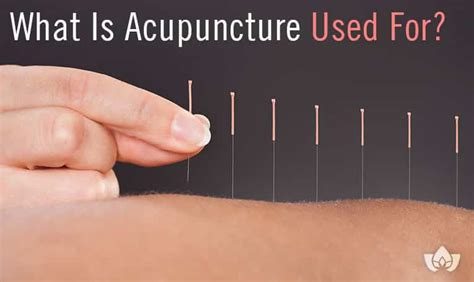 what is acupuncture used for.
